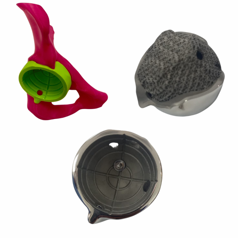 Recinstruccion hemicondilar con implante a la medida (4)