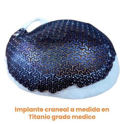 implante craneal